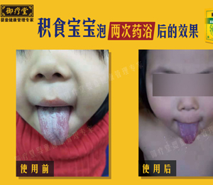  ������ˎԡ�eʳ������(du��)����̦ 1