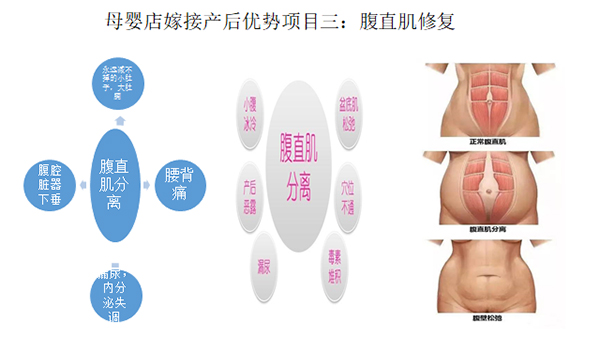   ���������îa(ch��n)���(xi��ng)Ŀ-��ֱ���ޏ�(f��)